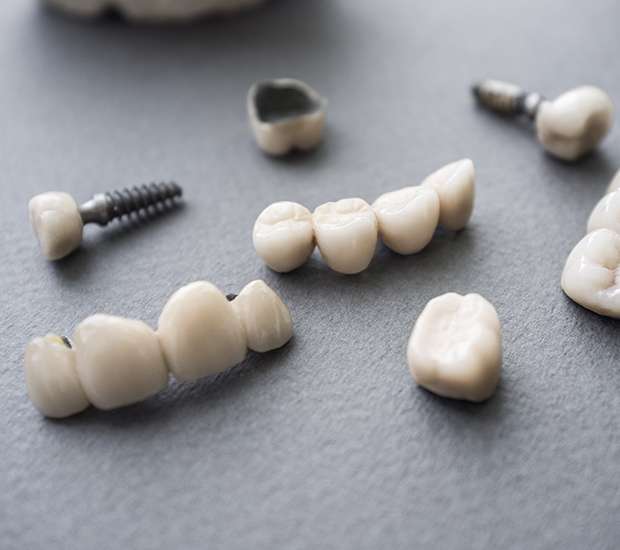 Doral The Difference Between Dental Implants and Mini Dental Implants
