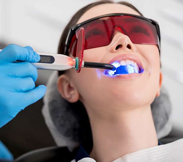 Doral Professional Teeth Whitening